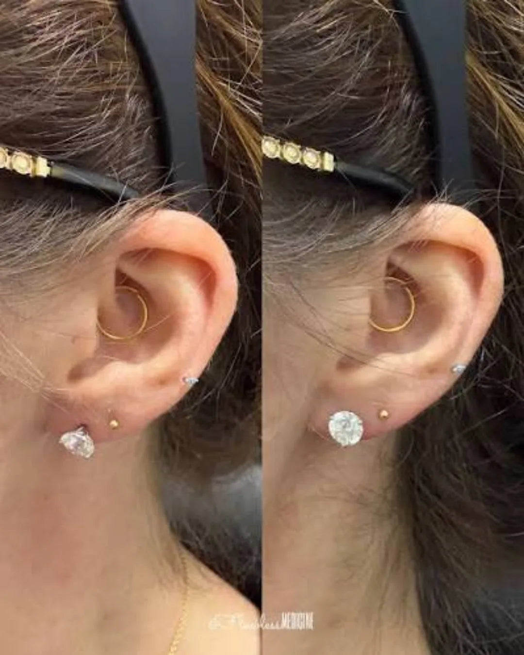 Gold Plated Lobe Lifter Earring Backings